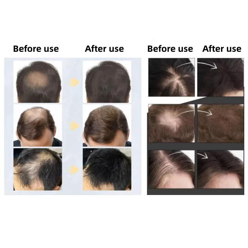 20pcsHair Fiber Keratin Hair B - đánh giá và giá Hair Care Natural Products
