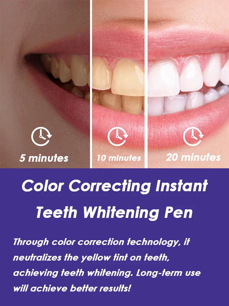 No Sensitivity, All Brightness: Purple Instant Teeth Whitening Pen for Stain-Tartar Clean & Radiant Smile