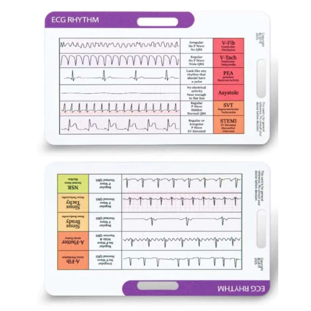 Quick Reference Ekg…