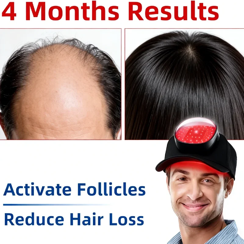 Best 96 Diodes Laser Hair Cap, LLLT Therapy for Anti Hair Loss Promote Regrowth Restore Thickness