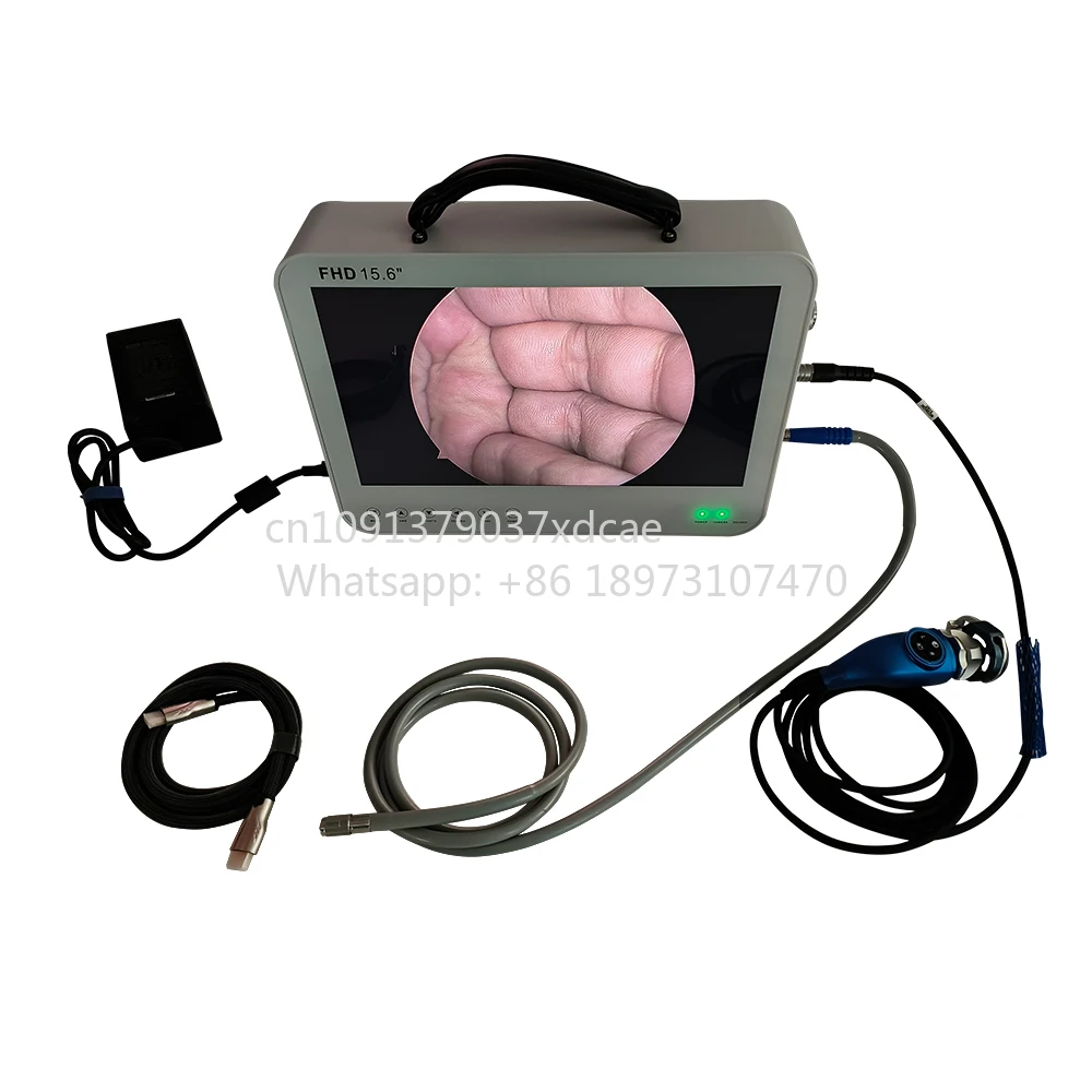 Camjoy 15.6 Inch Portable Full HD Endoscopy Camera For ENT Laparoscopy Urology PTSD