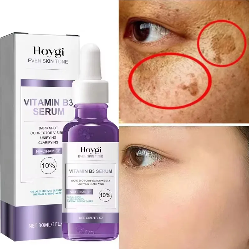 Powerful Dark Spots Remover B3 Whitening Serum Freckle Melanin Correcting Anti Pigmentation Brighten Skin Beauty Care Products