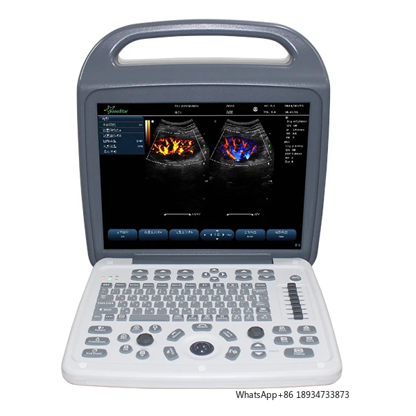 Laptop Color Doppler Ultrasound Scanner C10M