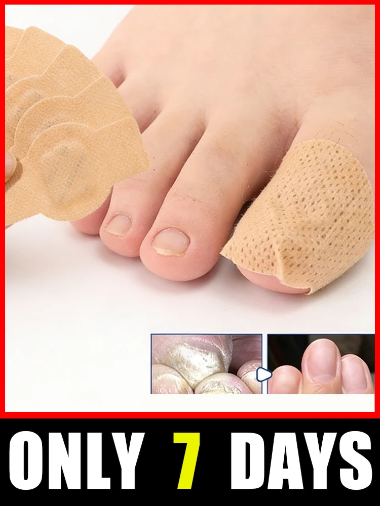 

Dᴇᴇᴘʟʏ ɴᴏᴜʀɪsʜᴇs ᴅʀʏ, ᴄʀᴀᴄᴋᴇᴅ ᴄᴜᴛɪᴄʟᴇs; sᴄᴜʟᴘᴛs ᴀɴ ᴇxᴏ̨ᴜɪsɪᴛᴇ, sᴏᴘʜɪsᴛɪᴄᴀᴛᴇᴅ ɴᴀɪʟ sʜᴀᴘᴇ