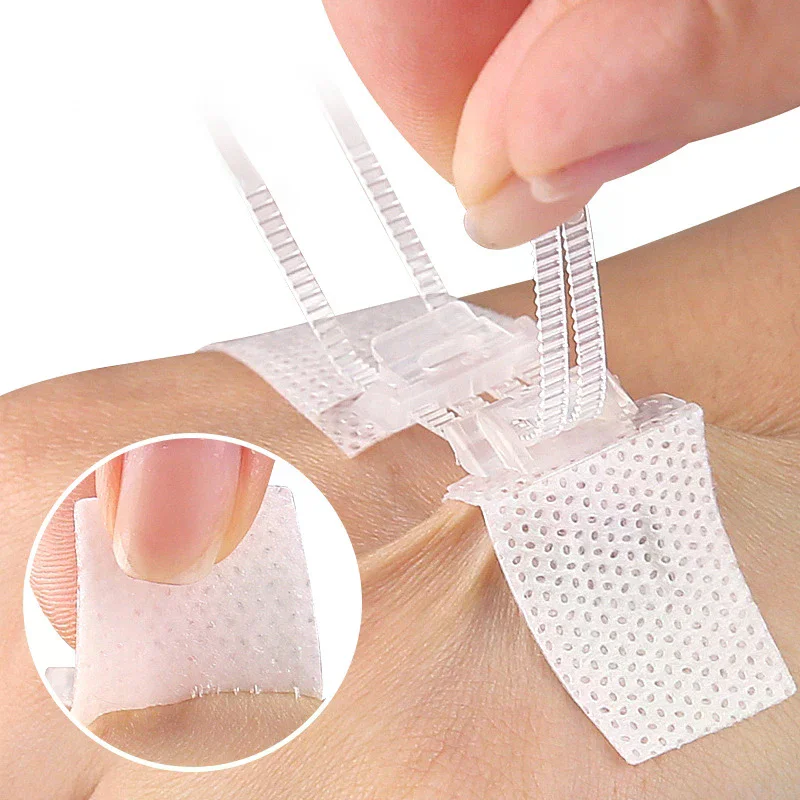 Zipper Band-aid Painless Wound Closure Patch Suture-free Wound Dressing Patches Zip Suture Reducer Band Aid Outdoor