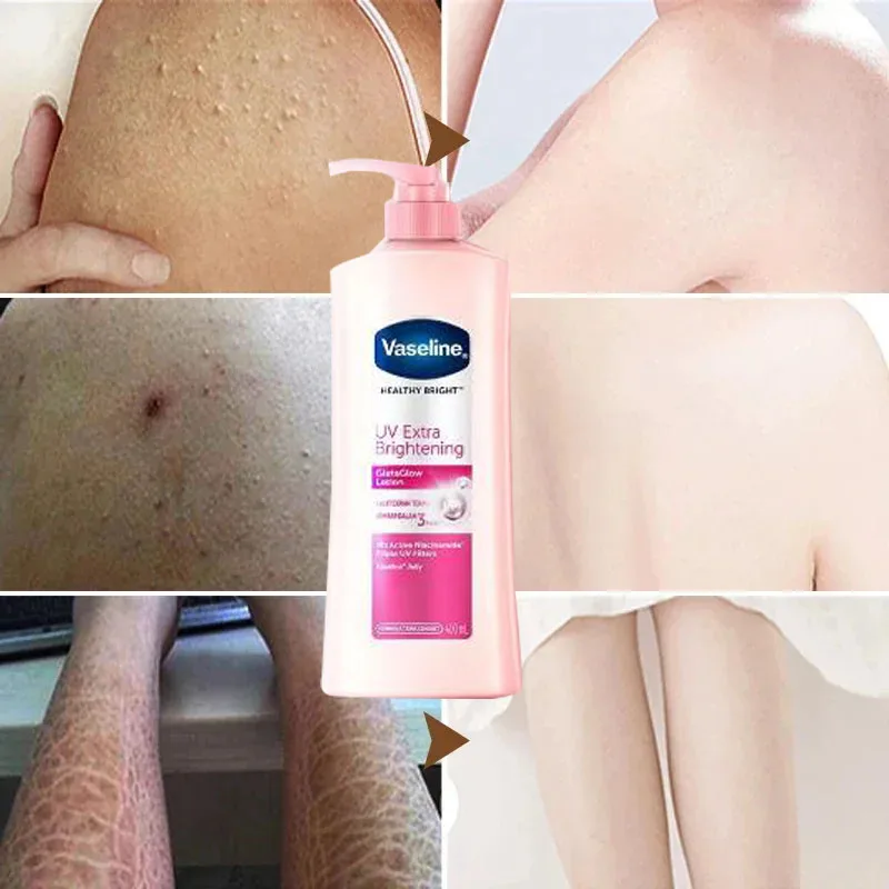 Vaseline Niacinamide Bodylotion Verlicht De Droge En Gedehydrateerde Huid Exfolieert En Verheldert Huidskleur Hydraterende Bodylotion 400Ml