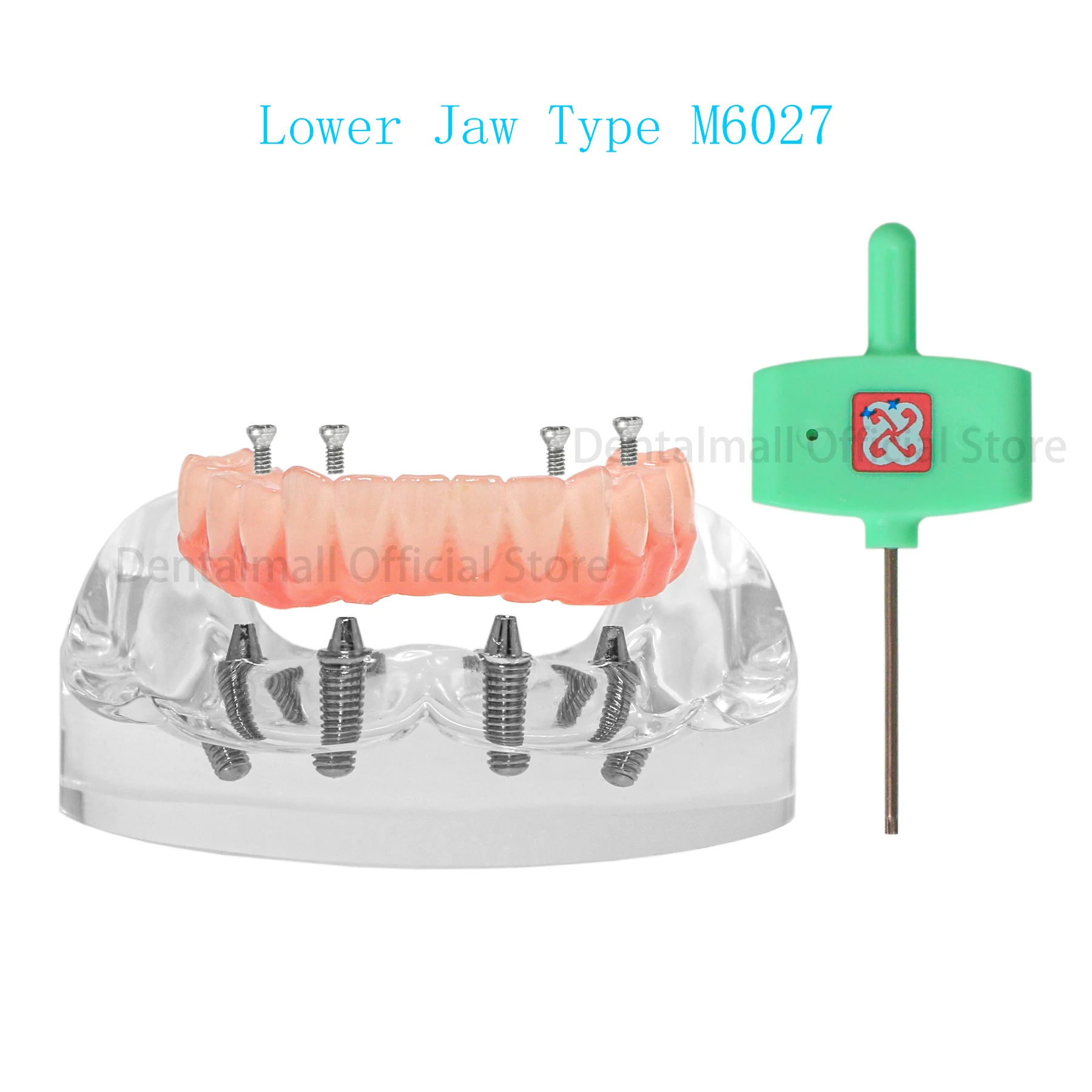 Dental Teeth Model Simulation Restoration Implant Model Lower Jaw 4 Screws Post Core Bridge M6027