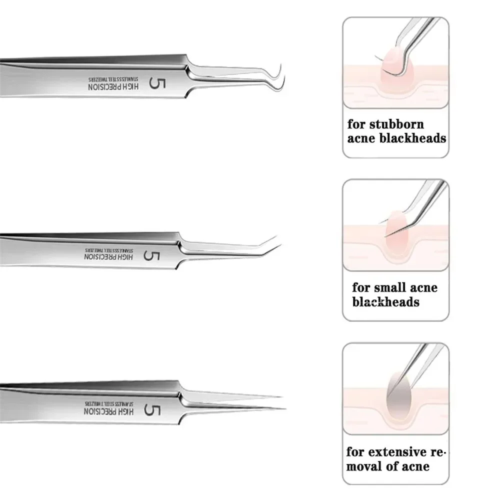 Pinzas de Clip de espinillas ultrafinas alemanas, herramientas de aguja de acné, artefacto especial de raspado y cierre de salón de belleza, n. ° 5