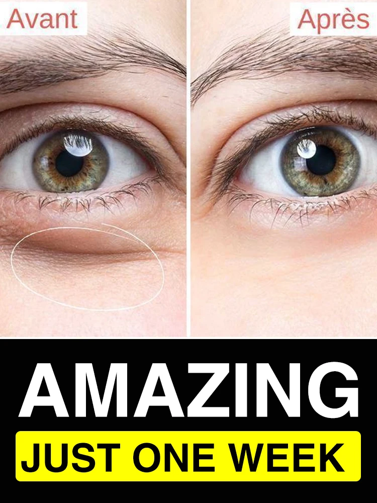 

Eye Cream Firming Moisturizing Eye Bags Enhancing Skin Elasticity Eye Care