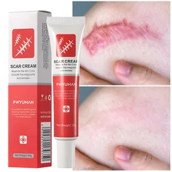 Fast Scar Removal Cream Treatment Stretch Marks Burn Surgical Scar Acne Spots Repair Gel Whitening Smoothing Skin Care Products