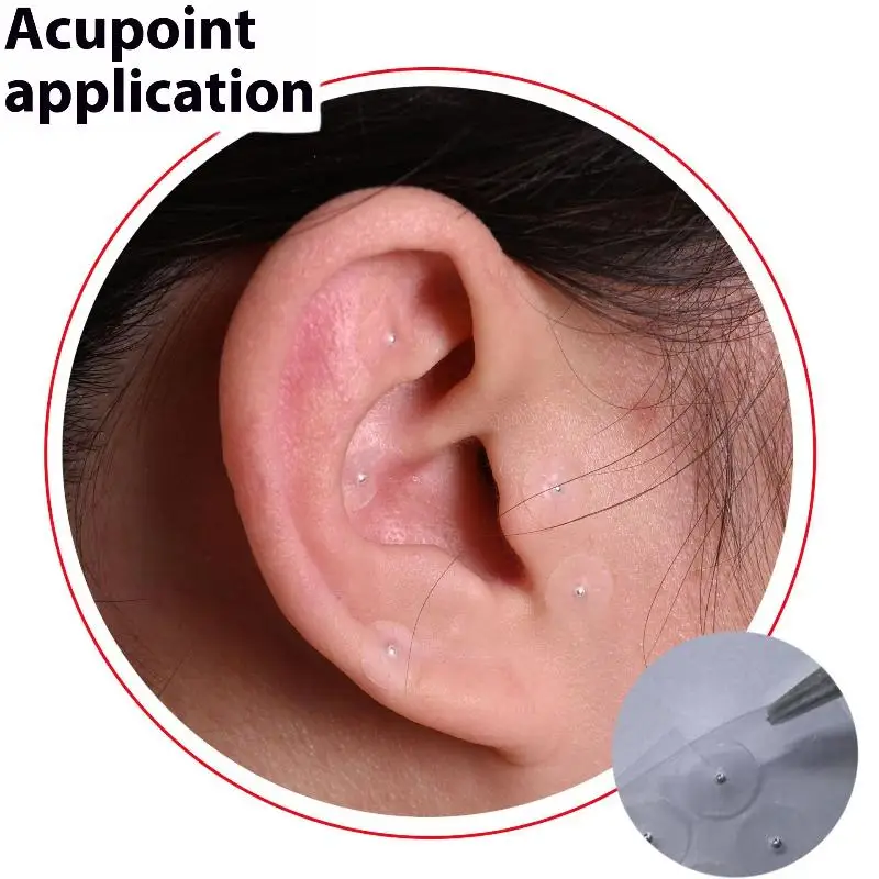 100Pcs Ear Bead Patch Auriculotherapy Breathable Acupressure Ear Press Bead Patch Sticker Acupressure Bead Patch