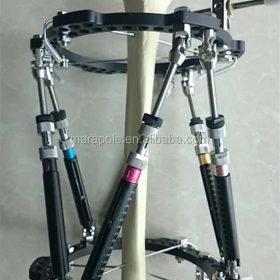 The Taylor SPATIAL FRAME for External fixation