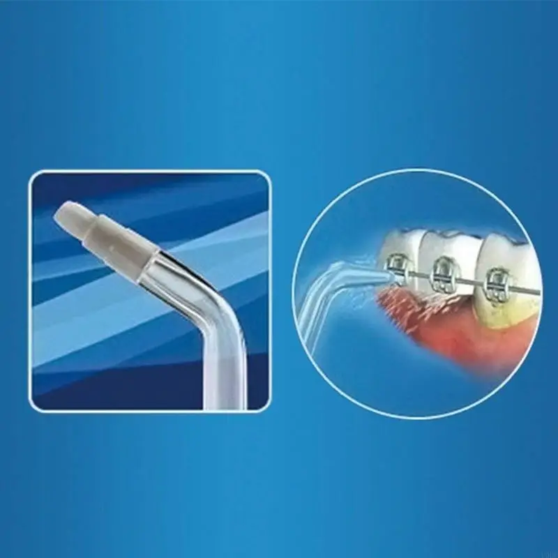 Orthodontic Tips for Waterpik Water Flossers Irrigators Random Color