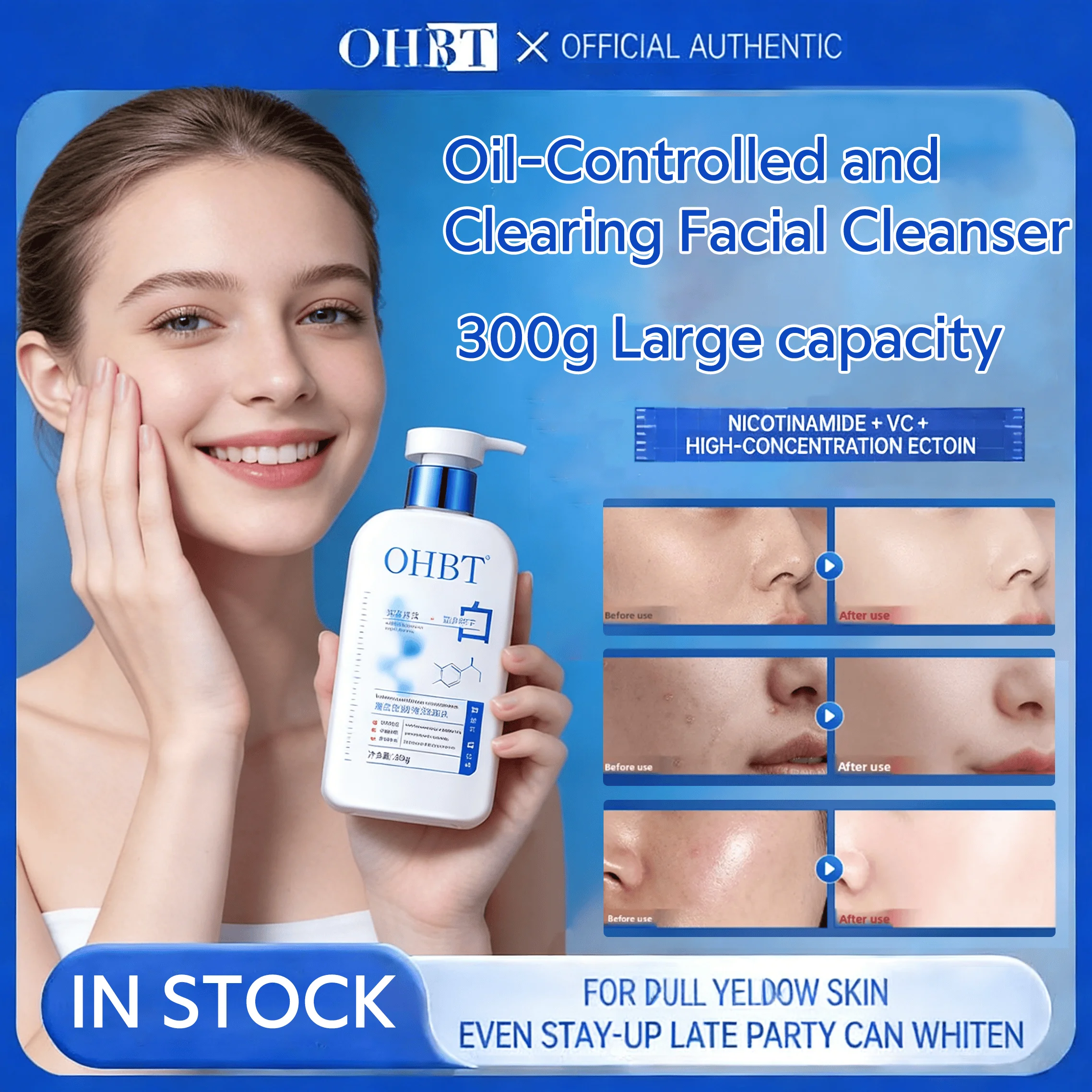 Ohbt Nicotinamide F…