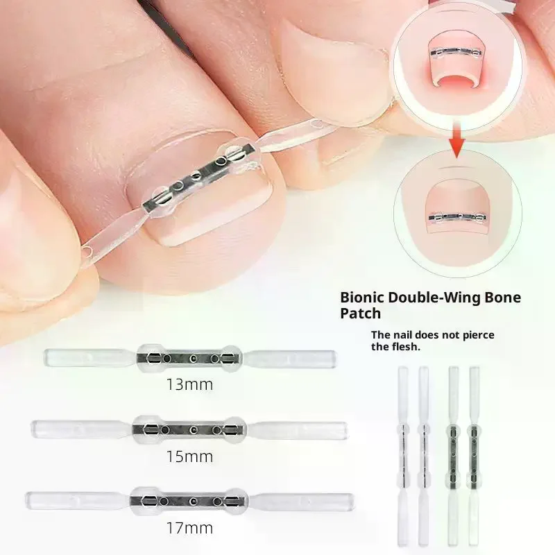 Werkzeuge zur Korrektur eingewachsener Zehennägel, Pediküre, Wiederherstellung, Einbettung der Zehennägel, professionelle Clip-Klammer zur Glättung eingewachsener Zehennägel