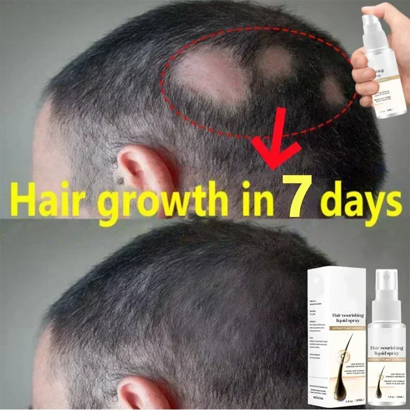 Ginger Hair Growth Spray para homens e mulheres, Promover rápido mais grosso, cabelos mais longos, rebrota radicular, soro, prevenir a calvície, Anti Hair Loss Care