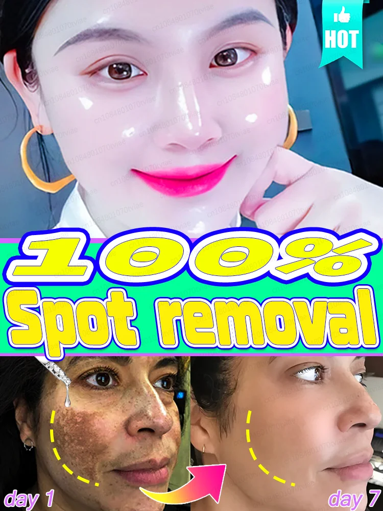 

Sᴘᴏᴛ Rᴇᴍᴏᴠᴀʟ Manage your skin with 100% safety and effectiveness, helping all your pigmentation concerns fade away.