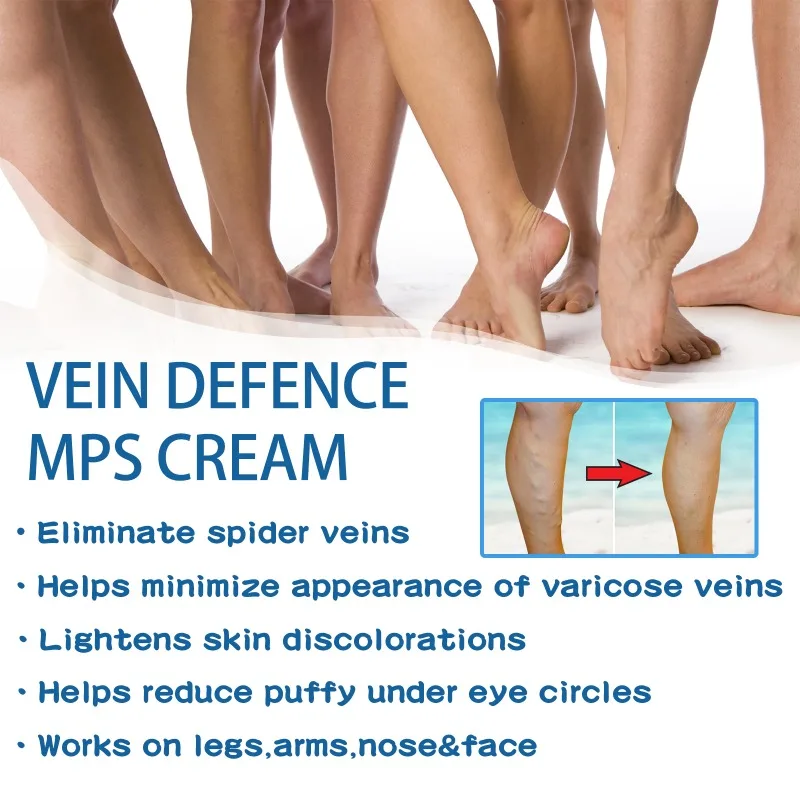 Instituts Cream to Charleroi Leg Vasculartis and Phlébitis, Spider-oto, Gonflement, Pommade de soin pour varices, Efficace pour les varices