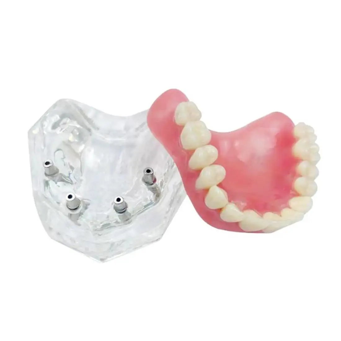 

Зубная модель нижней челюсти с 4 имплантатами для обучения и изучения (верхняя челюсть)