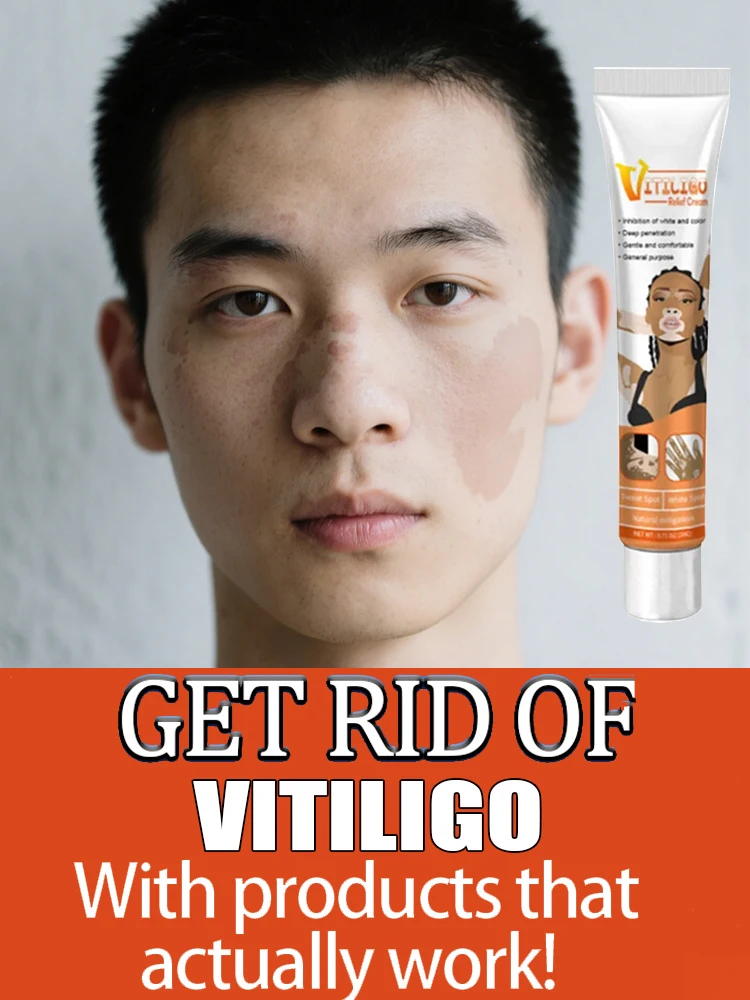 

[New] Vitiligo Cream Vitiligo Remover Tinea Versicolor Body Lotion Helps Get Rid of Sweat Spot Vitiligo, Skin Vitiligo Clear