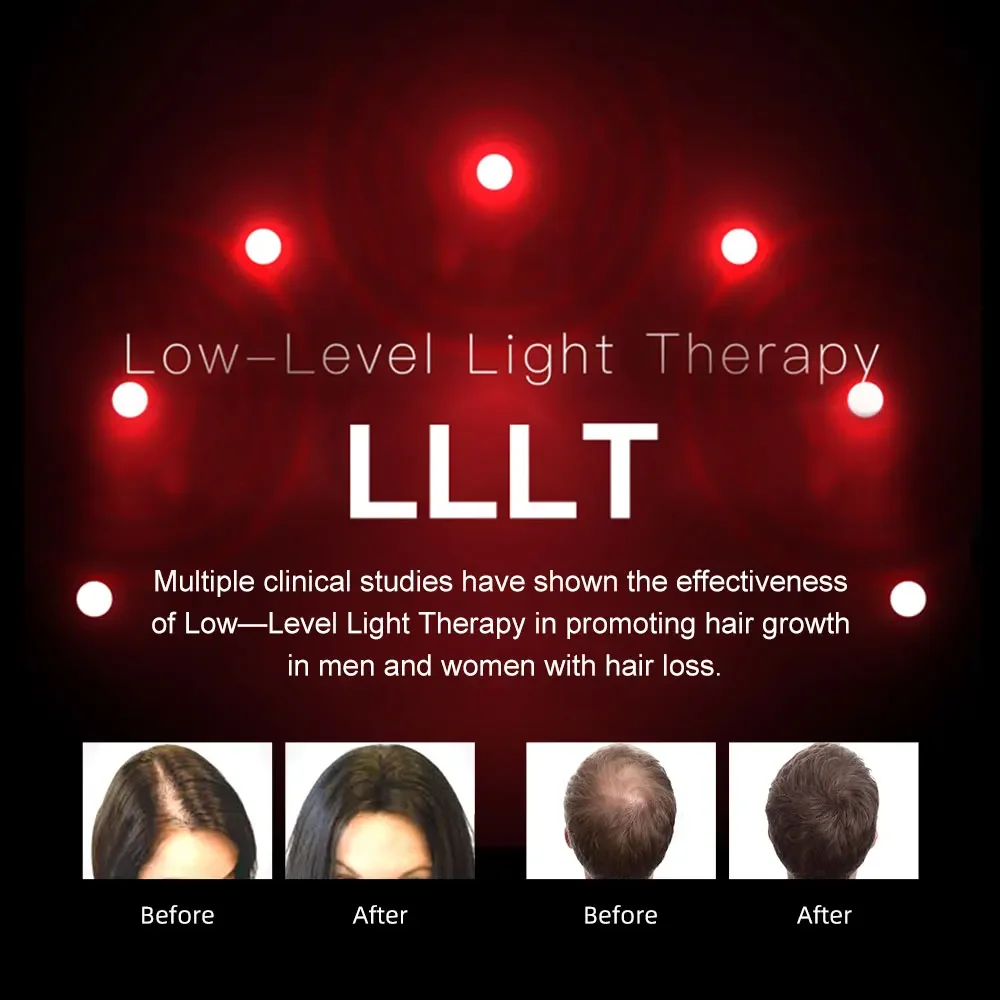 SGROW vendita calda ricrescita dei capelli laser a infrarossi Dispositivo per casco per terapia laser per crescita dei capelli con luce a led rossa per uso domestico