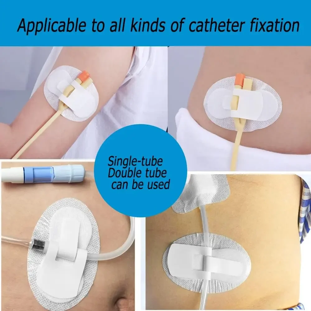 Dispositivo di stabilizzazione del catetere Catetere Borsa per gamba urinaria Supporto per fascia per gamba Adesivo per supporto per fascia per gamba (confezione da 10)