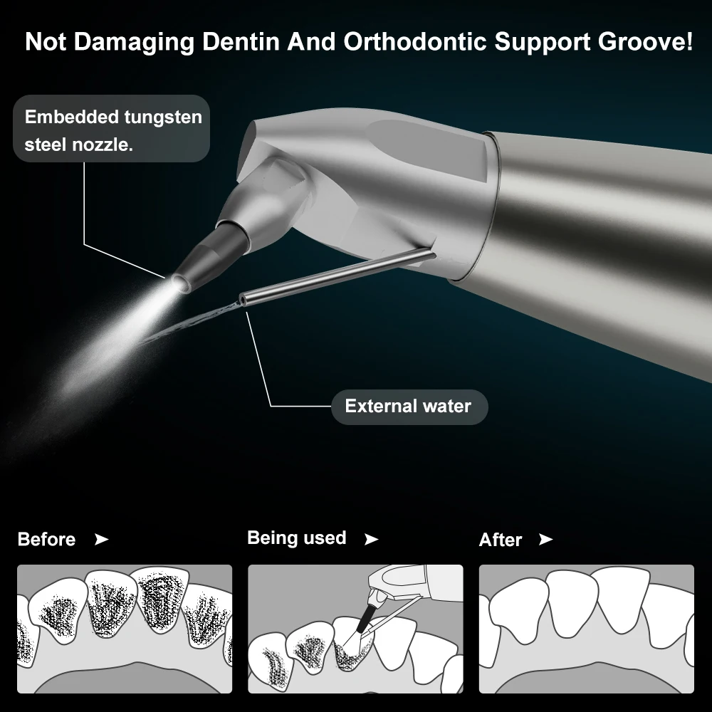 Dental Aluminum Oxide Air Abrasion Polisher Dental Sandblasting Gun connect K/N-Coupling with External Water Spray AI-AP3