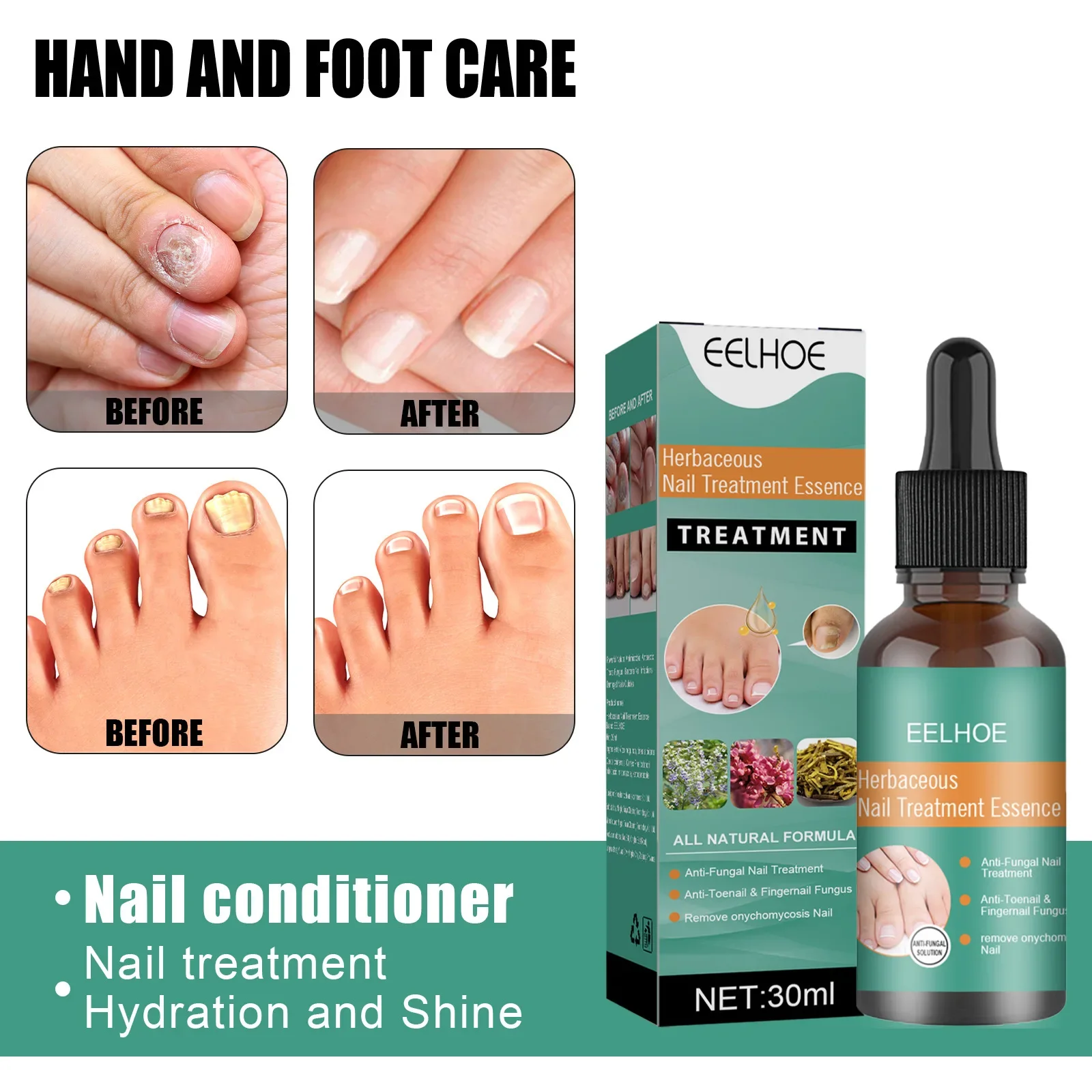 Gel de gratitude pour les ongles du pied, élimination de la brillance, problème de stratification des ongles, UNIS issement de la surface inégale, teigne jaunissante, N64.