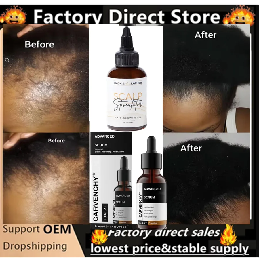 

Усовершенствованная сыворотка для ухода за волосами с несколькими пучками для повышения плотности волос и кожи головы для всех типов волос