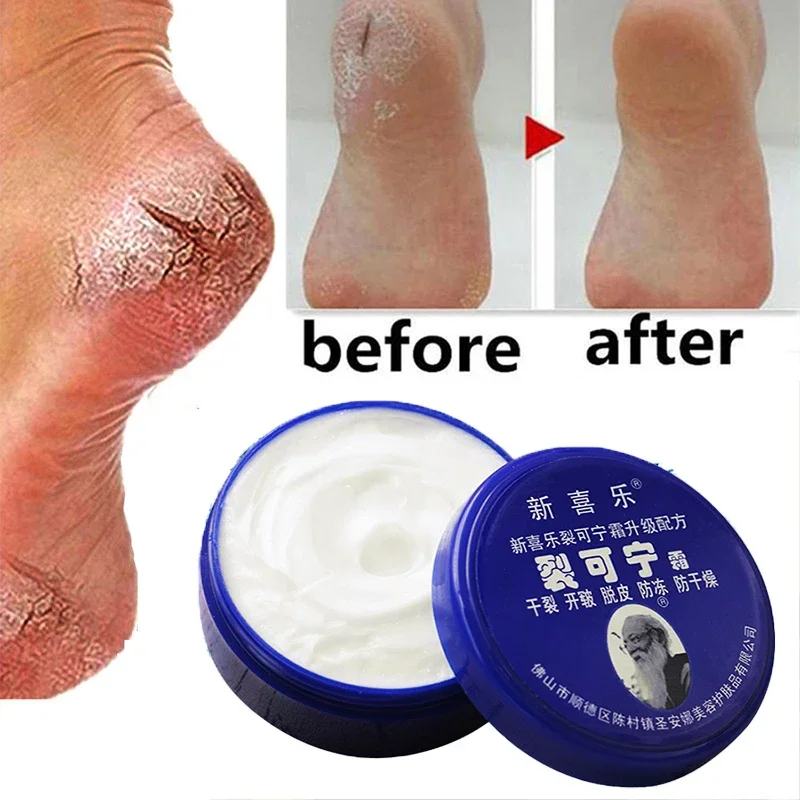 

Herbal Anti Crack Foot Cream Anti-Drying Heel Cracked Moisturizing Repair Lotion Removal Dead Skin Anti-Aging Smooth Skin Care