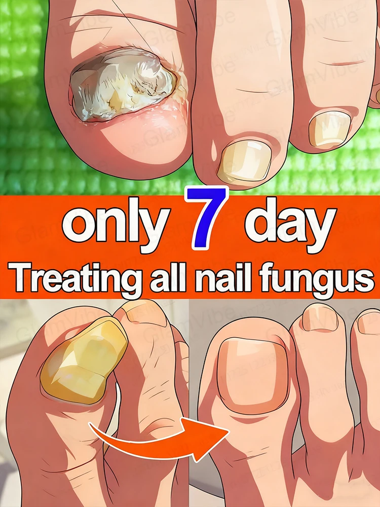 

Cᴜsᴛᴏᴍɪᴢᴇᴅ sᴏʟᴜᴛɪᴏɴs ᴛᴏ ʀᴇsᴛᴏʀᴇ ʜᴇᴀʟᴛʜʏ ᴀɴᴅ ʜᴇᴀʟᴛʜʏ ɴᴀɪʟ ᴛᴇxᴛᴜʀᴇ