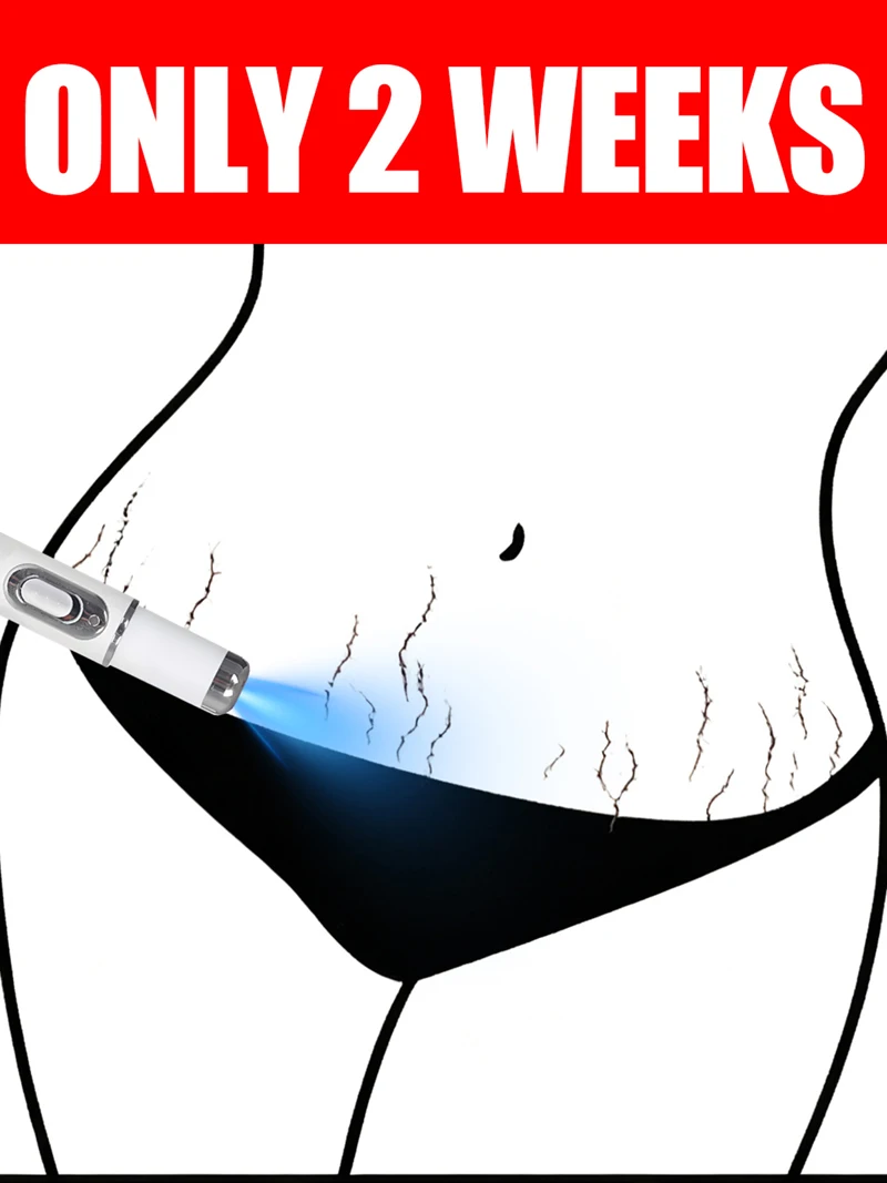 

blue light pen to solve body Stretch Marks, Maternal Skincare Tools