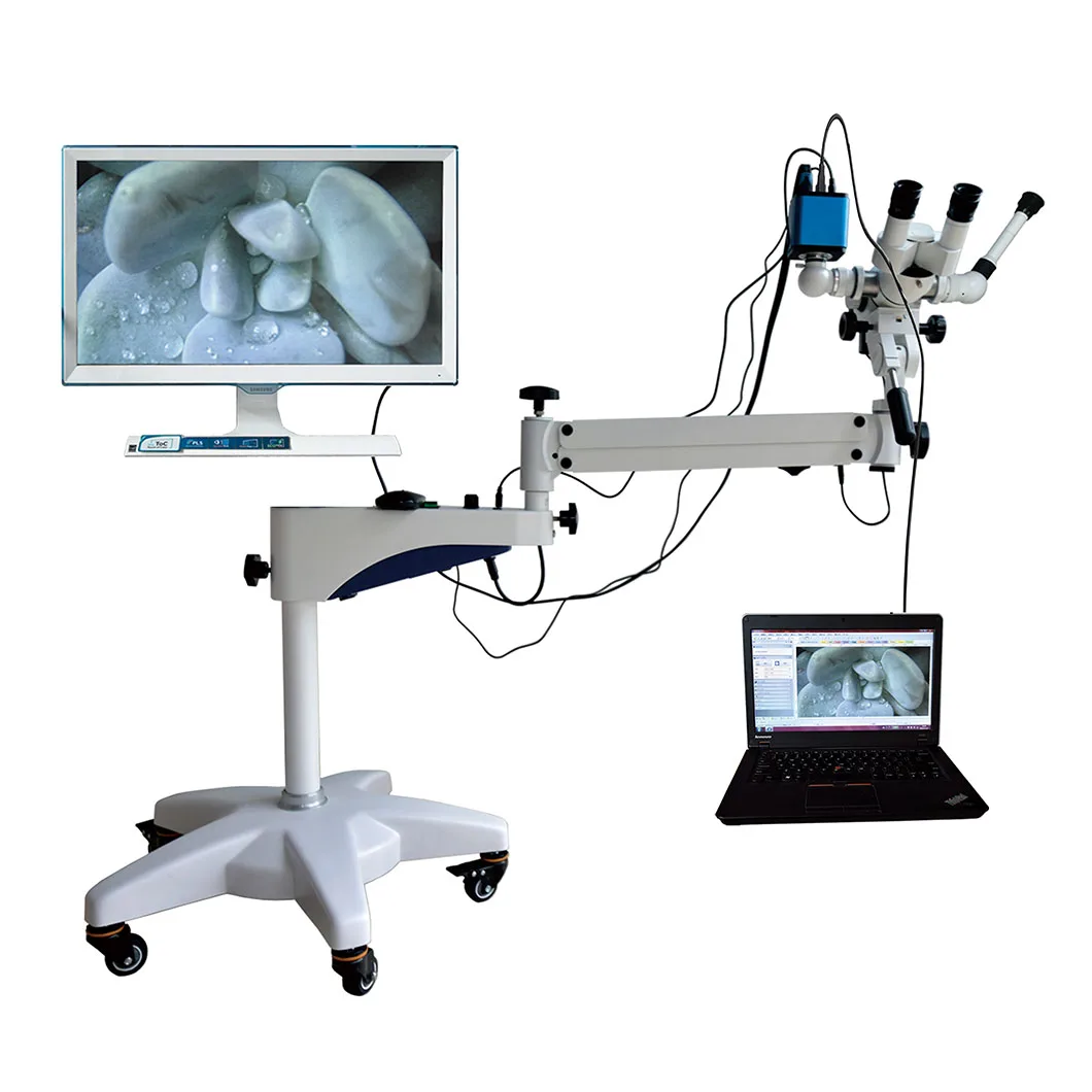 YDJ-II Series Gynecologic Examination Use Vaginal Diagnosis Portable Digital Video Colposcope