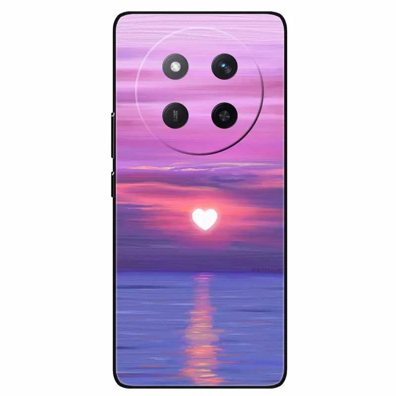 For Honor MAGIC 7 Lite Pro Case Soft Silicon Marble Painted Cover for Honor Magic7 Lite TPU Coque Magic7Lite 7Lite Magic7 Pro 5G