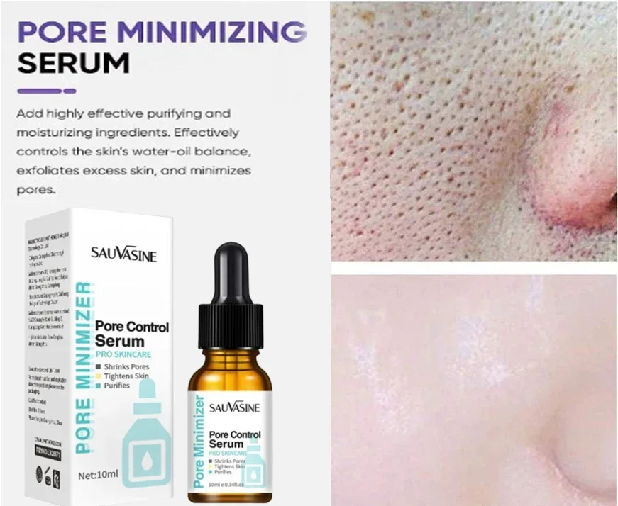 

Acid Pore Shrinking Serum Face Removing Large Pores Tightening Repairing Facial Pore Minimizing Essence Oil Firm Skin Care210