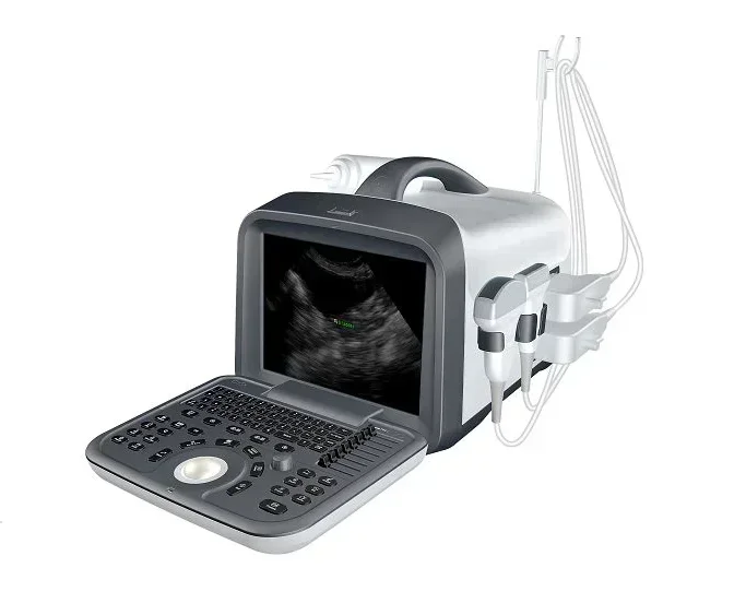 Portable B/W Ultras…