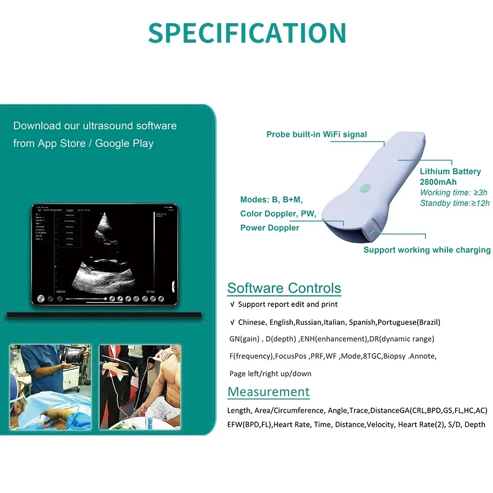 

Multipurpose Wireless Ultrasound Scanner with Dual Head Convex Linear Cardiac Preset 3 in 1 Probe C10RL for Comprehensive Imagin