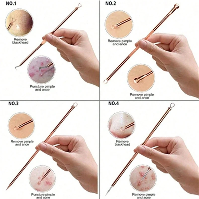 Estrattore per la rimozione di punti neri da 4 pezzi/set, kit di pinzette curve, kit di strumenti professionali per la rimozione dell'acne in acciaio inossidabile