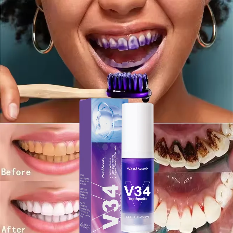 

Teeth Cleansing Whitening Toothpaste Whiten Gel Whitener Bleach Removes Stains Fresh Breath Tooth Cleaning Korea Products