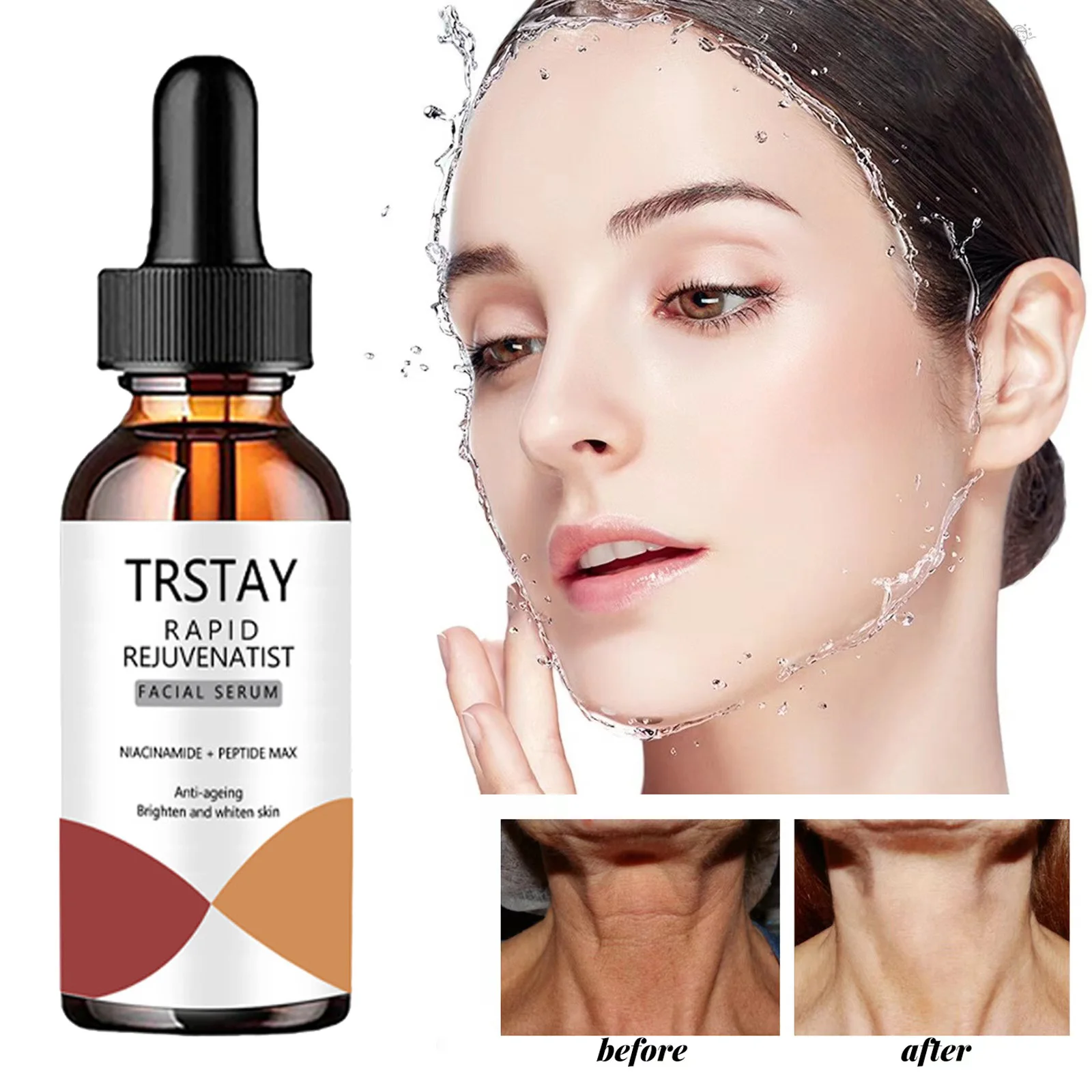 

5ML/15ML/30ML/50ML/TRSTAY Nicotinamide Essence Can Remove Black Spots, Whiten And Brighten Pores, Shrink Hyaluronic Acid Collage