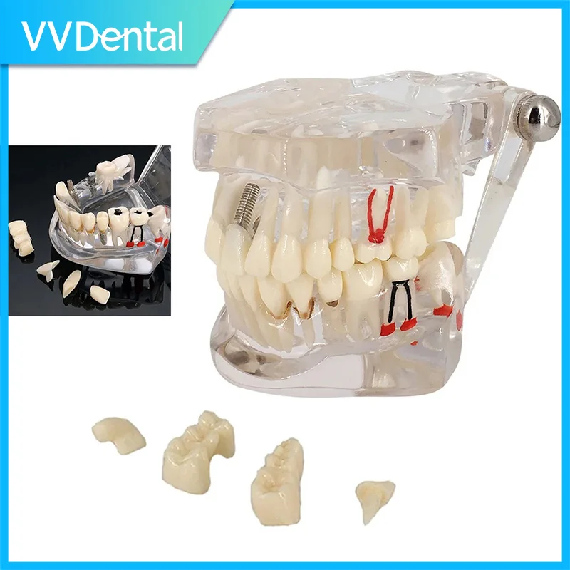 Category image: Dental Teaching Model