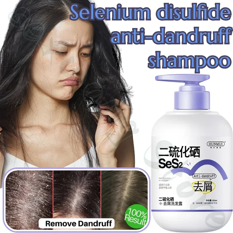 

Anti-dandruff Shampoo, Refreshing, Anti-itch, Clean Scalp, Oil Control, Anti-dandruff, Moisturizing and Cleansing Shampoo 350ml