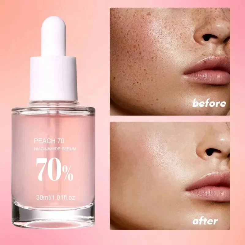 พีช 70% Niacinamide Serum 30ml ป้องกันความแห้งกร้านน้ํามันหอมระเหยบนใบหน้าเพิ่มความยืดหยุ่นเรียบเนียนนุ่ม Skin Care