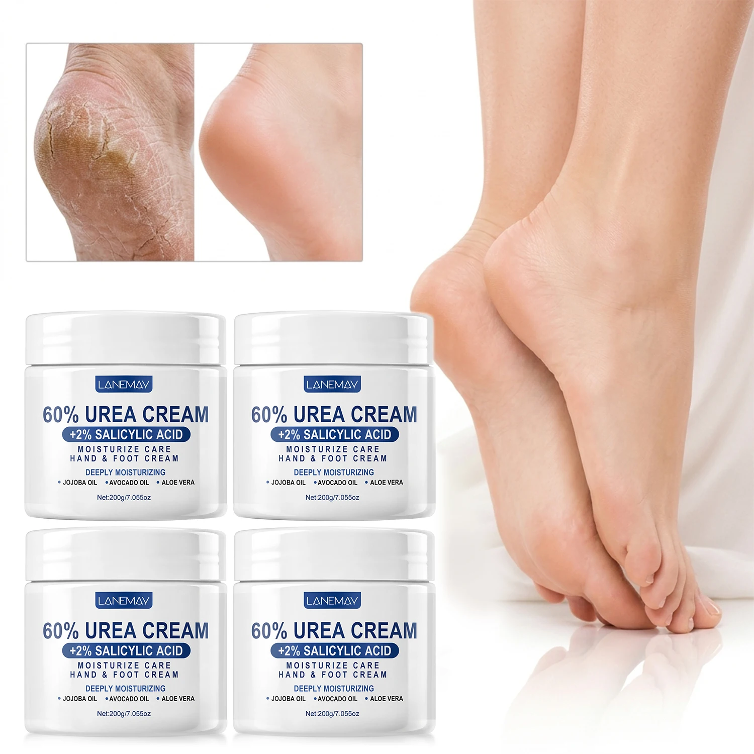 Urea Cream 60% with 2% Salicylic Acid - Foot Cream for Dry Cracked Heels, Callus Remover for Feet Knees Elbows Hands, 4 X 200g