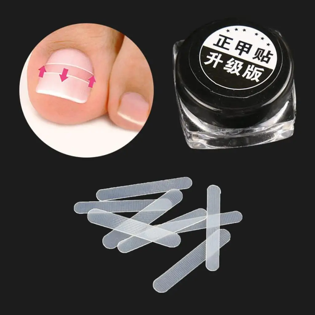 Autocollants pour traitement des ongles incarnés, patch élastique, outils de pédicure, 10 pièces