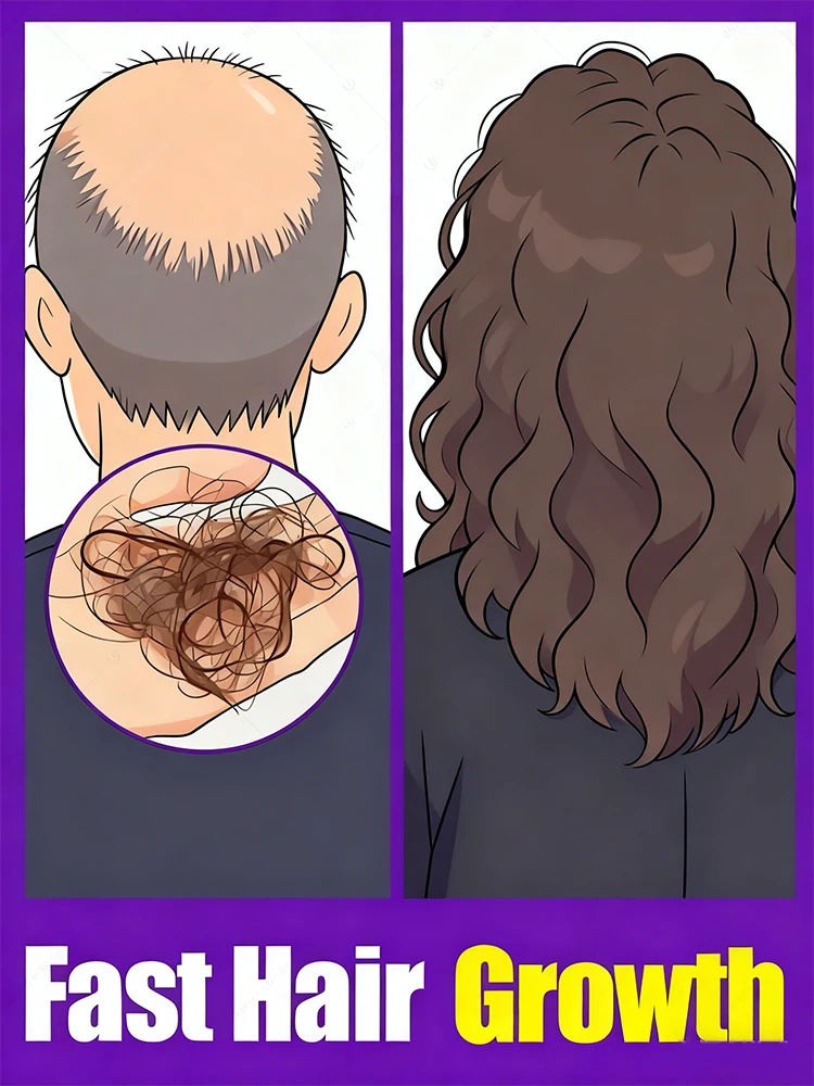 

Bᴀʟᴅɴᴇss ᴡᴏʀʀɪᴇs Hᴀɪʀ ɢʀᴏᴡᴛʜ ᴘʀᴏᴍᴏᴛᴇs ʜᴀɪʀ ɢʀᴏᴡᴛʜ ɪɴ 7 ᴅᴀʏs