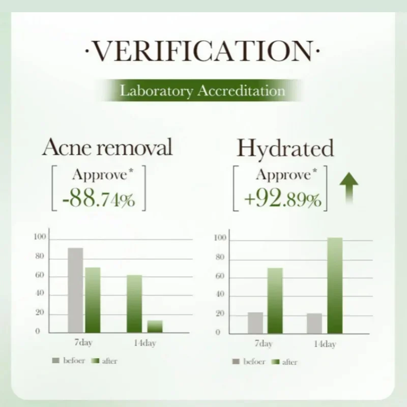 サリチル酸毛穴クリアリングクリーム毛穴を縮小黒ずみ除去にきび明るく保湿スムーズなスキンケア韓国製品