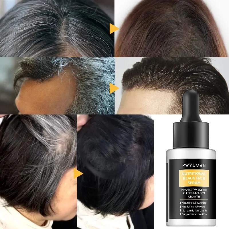 Serum perawatan rambut abu-abu putih hitam alami minyak penumbuh rambut cepat tumbuh kembali Anti rambut rontok Kecantikan Kesehatan Pria Wanita