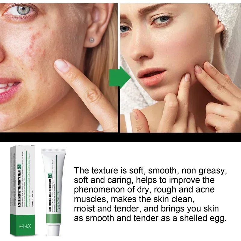 

Sdottor Acne removing cream Whitening Freckles lightens Dark Spots Melasma Melanin bright skin repair Firming Moisturizing face