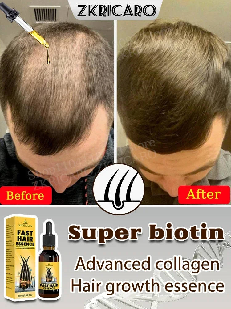 2025, hair growth oil, baldness repair, hair roots, seborrheic alopecia, universal hair growth for men and women